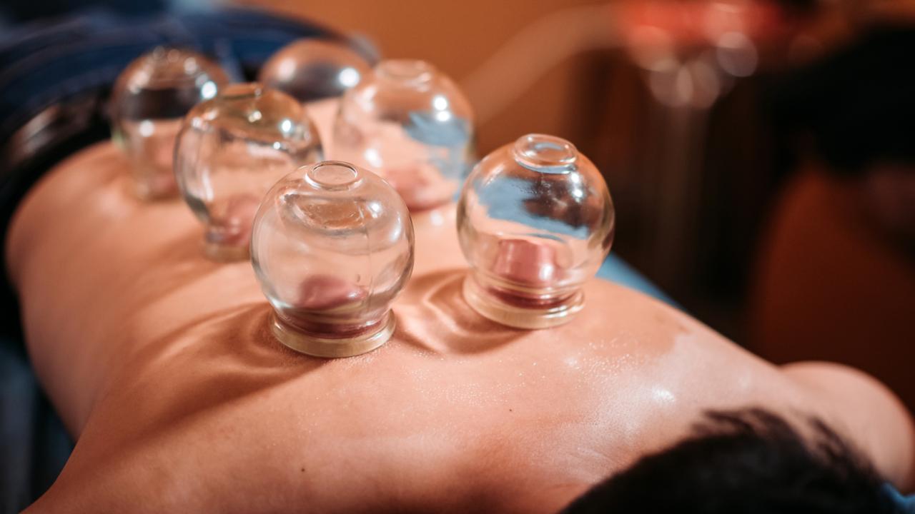 Kupa Tedavisi: Geleneksel Uygulamanın Sağlık Üzerindeki Kupa Tedavisi: Geleneksel Uygulamanın Sağlık Üzerindeki