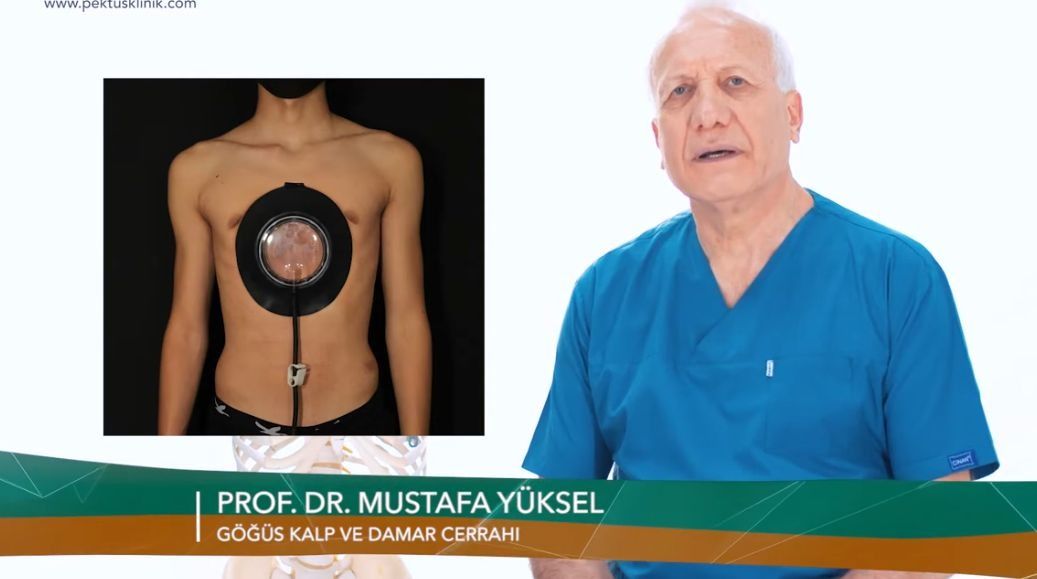 Pektus Hastalığı İçin Devlet Desteği Yetersiz Kalıyor Pektus Hastalığı İçin Devlet Desteği Yetersiz Kalıyor